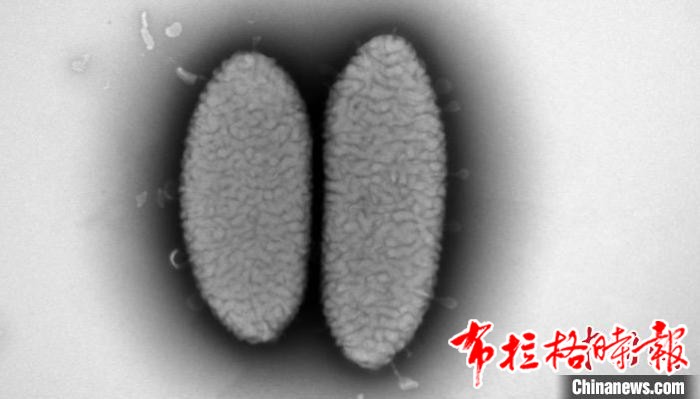 image051 - 【布拉格时报】广东丹霞山发现微生物新属新种——丹霞红岩杆菌